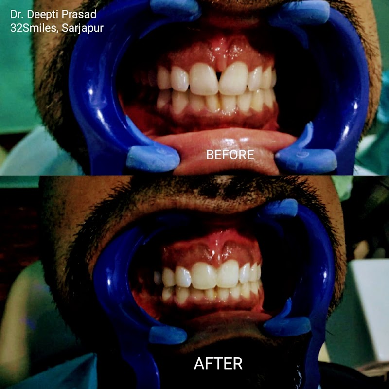 Location Photo 2: New Smile Multispeciality Dental Clinic Munnekollal Bengaluru