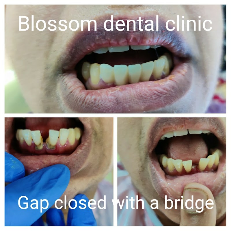 Location Photo 1: Blossom Dental Clinic Whitefield Bengaluru